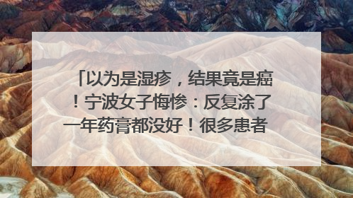 以为是湿疹，结果竟是癌！宁波女子悔惨：反复涂了一年药膏都没好！很多患者首诊都去了皮肤科