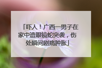 吓人！广西一男子在家中遭眼镜蛇突袭，伤处瞬间剧痛肿胀